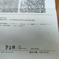 3月20日---恶性黑色素瘤确诊