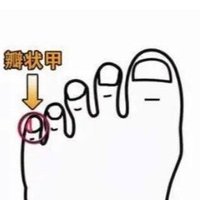 若你的小脚趾有2瓣趾甲，或许不是纯正汉人，而是这一种族的后裔