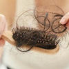 脱发严重是什么原因引起的？谨防12大头发护理风险隐患！