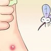 驅蚊神器告訴你，蚊蟲叮咬與血型沒關系！