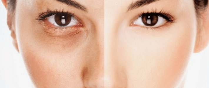  好价买好货之护肤篇：网易考拉OLAY高性价比单品盘点