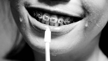 关注孩子牙齿 篇二：钢牙妹迎来了春天给牙齿做清洗就是如此简单 