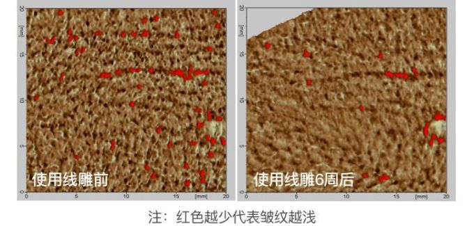 抗衰精华真能防老?人肉测试42天最有效的居然是…
