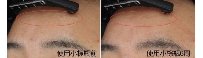 抗衰精华真能防老?人肉测试42天最有效的居然是…
