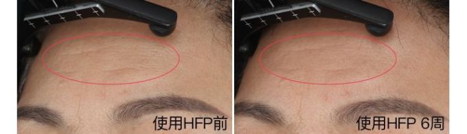 抗衰精华真能防老?人肉测试42天最有效的居然是…