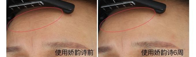 抗衰精华真能防老?人肉测试42天最有效的居然是…