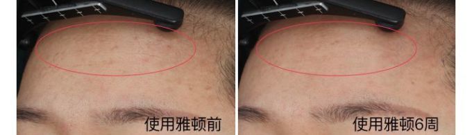 抗衰精华真能防老?人肉测试42天最有效的居然是…