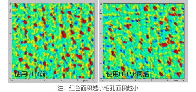 抗衰精华真能防老?人肉测试42天最有效的居然是…