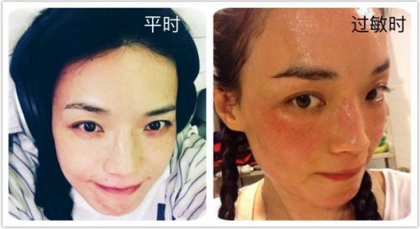 敏感肌专用化妆品真的温和不刺激?我用100只鸡胚胎做了实验…