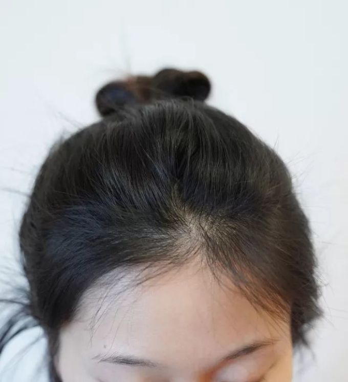为什么你是扁头?马尾/丸子怎么扎,头型可以更好看?