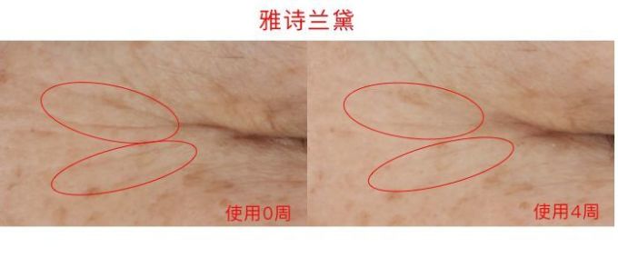 氪金40w评测10款热门眼霜,LA MER、小棕瓶、SK-II、大宝…你猜谁赢了?