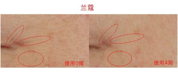 氪金40w评测10款热门眼霜,LA MER、小棕瓶、SK-II、大宝…你猜谁赢了?