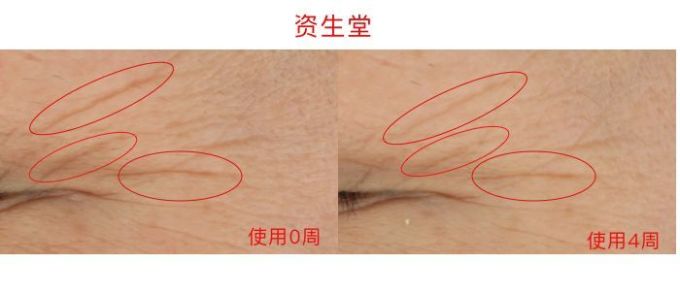 氪金40w评测10款热门眼霜,LA MER、小棕瓶、SK-II、大宝…你猜谁赢了?