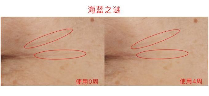氪金40w评测10款热门眼霜,LA MER、小棕瓶、SK-II、大宝…你猜谁赢了?