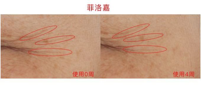 氪金40w评测10款热门眼霜,LA MER、小棕瓶、SK-II、大宝…你猜谁赢了?