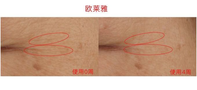 氪金40w评测10款热门眼霜,LA MER、小棕瓶、SK-II、大宝…你猜谁赢了?