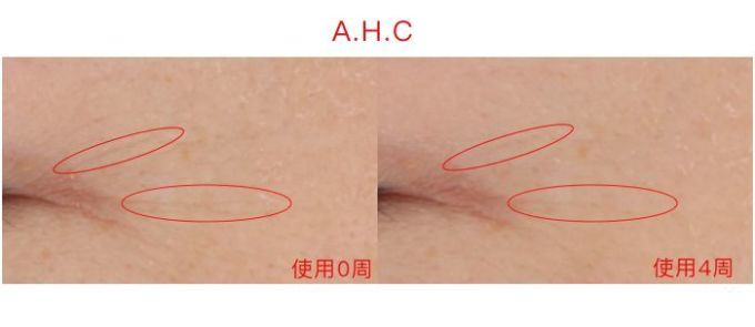 氪金40w评测10款热门眼霜,LA MER、小棕瓶、SK-II、大宝…你猜谁赢了?