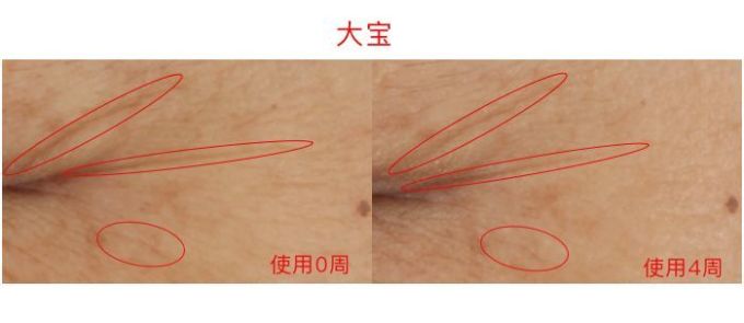 氪金40w评测10款热门眼霜,LA MER、小棕瓶、SK-II、大宝…你猜谁赢了?