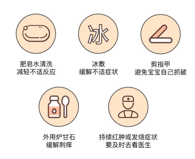 用了驱蚊液还是被咬了一身包 坚持十几年的方法居然是错的!