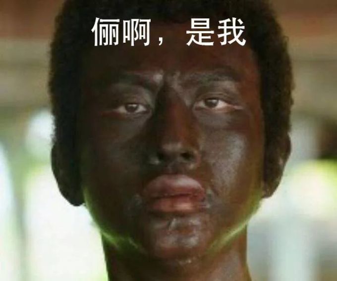 孙俪“全副武装”仍被晒伤,这5大防晒误区你中了几个?