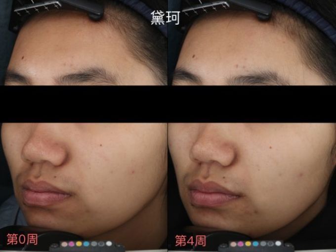 用光71瓶美白精华,你猜把SK-II秒成渣的精华是哪支?