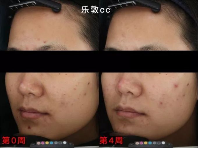 用光71瓶美白精华,你猜把SK-II秒成渣的精华是哪支?