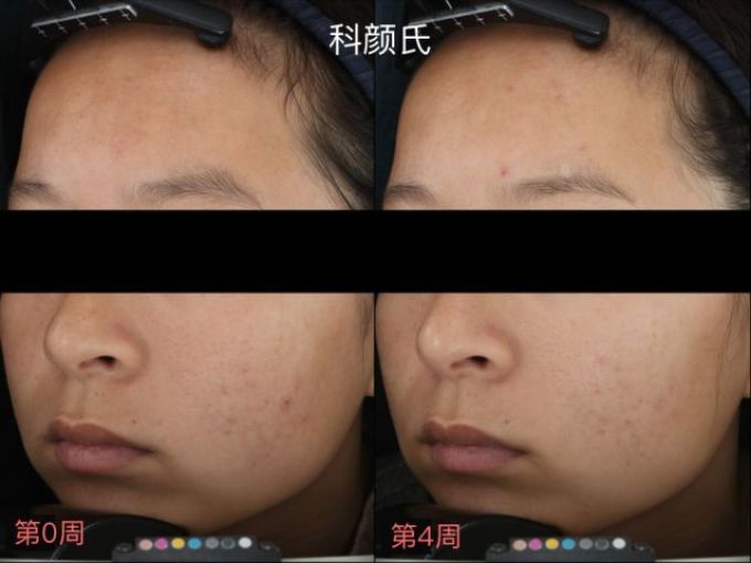 用光71瓶美白精华,你猜把SK-II秒成渣的精华是哪支?