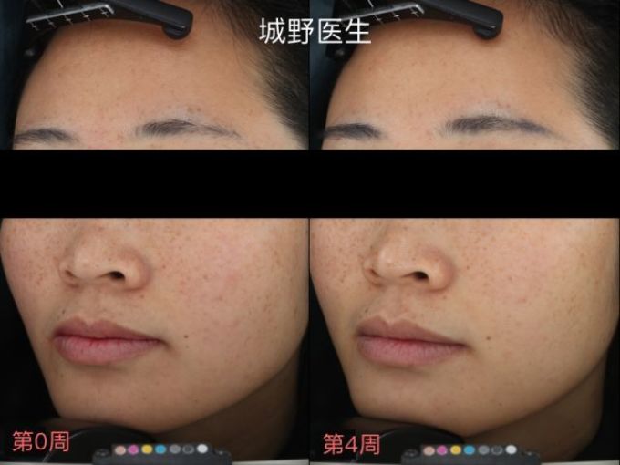 用光71瓶美白精华,你猜把SK-II秒成渣的精华是哪支?