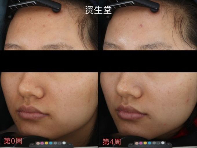 用光71瓶美白精华,你猜把SK-II秒成渣的精华是哪支?