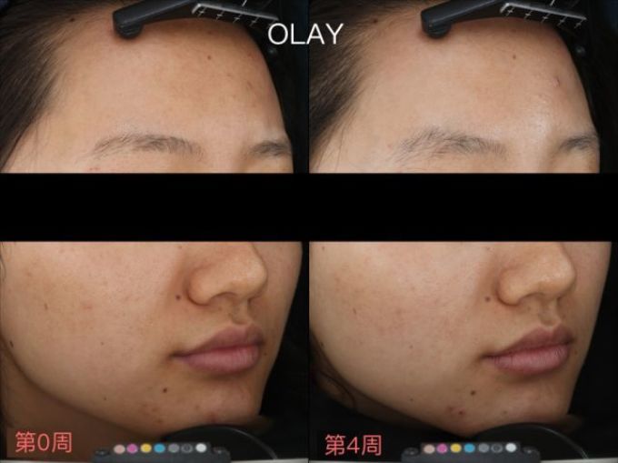 用光71瓶美白精华,你猜把SK-II秒成渣的精华是哪支?