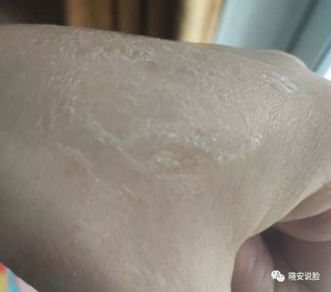 试图拯救一下搓泥的护肤品