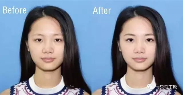 脸大脸宽怎么办？亲测有效的9种显脸小方法！