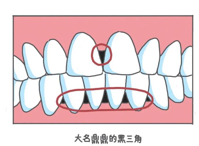 为我对含氟牙膏的偏见道个歉