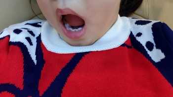 育儿经验 篇二：给牙齿涂层保护膜——儿童牙齿涂氟记