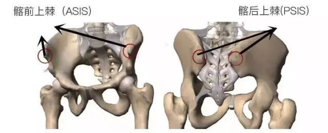 真翘臀or骨盆前倾？