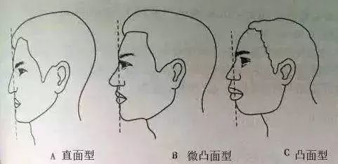 表情管理之修饰凸嘴：轻微凸嘴的人如何避免自曝其短？