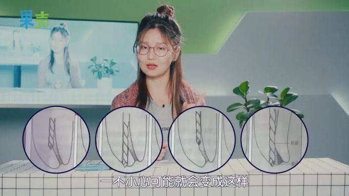 忍到牙不疼的那天,你收获了一份抽神经体验