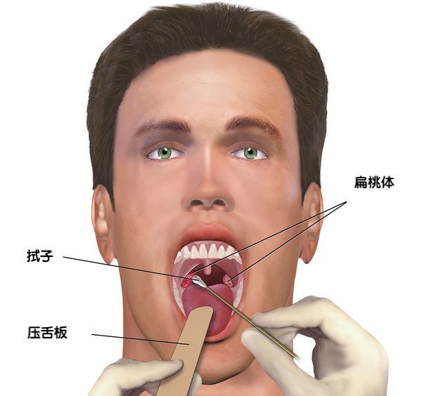 湖北省强调用CT检测新型肺炎?这样呼吁的理由有三个