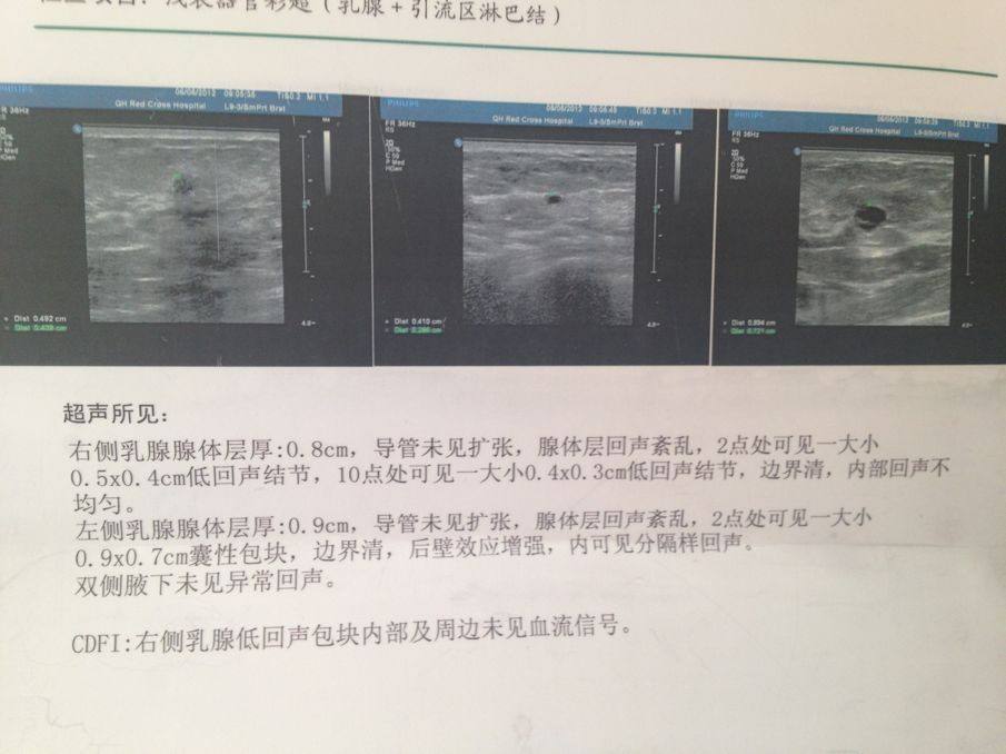 拒绝体检套路！怎么选择合适自己的体检项目？