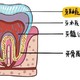 每天 2 次刷牙还有蛀牙？50% 以上人都不知道的蛀牙真相