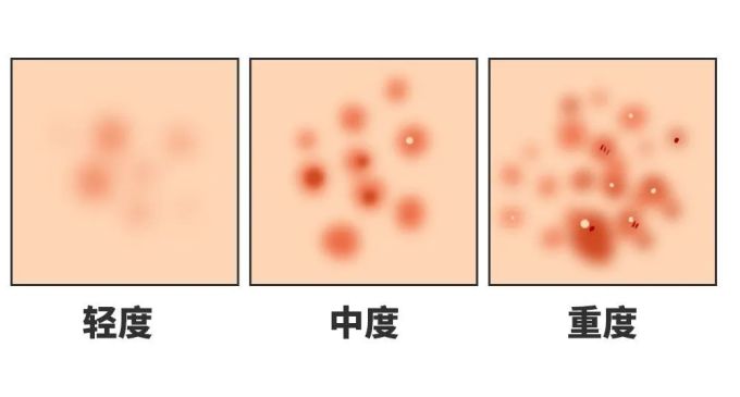 有的男生,摘了口罩就见不得人……