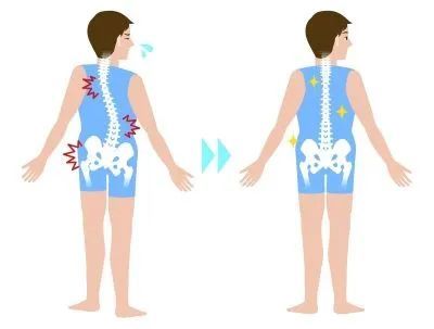 駝背脊柱側彎長短腿糾正孩子身姿問題每天練習這些動作就可以