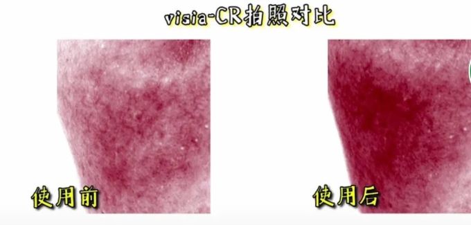 想要水润和修护,面霜应该怎么挑?