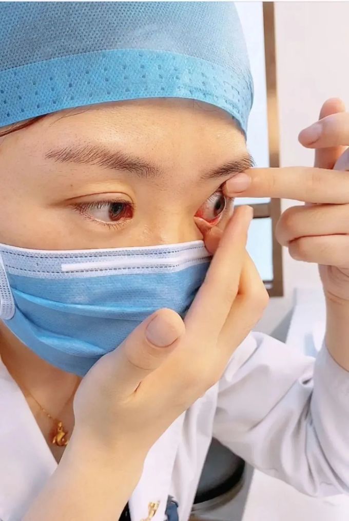 隐形眼镜应该怎么摘,80%的人都是错的!