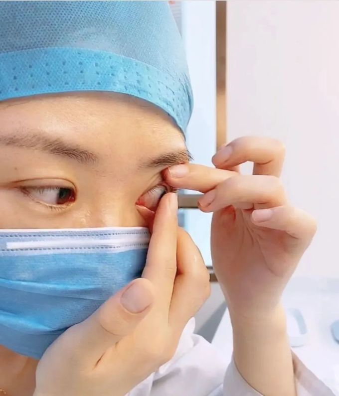 隐形眼镜应该怎么摘,80%的人都是错的!