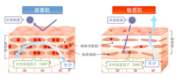 躲不过的换季护肤难题——敏感肌该怎么护理？