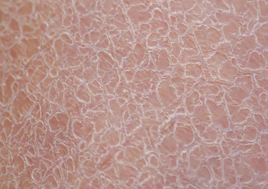 世上近一半的人，都有天生的皮肤缺陷