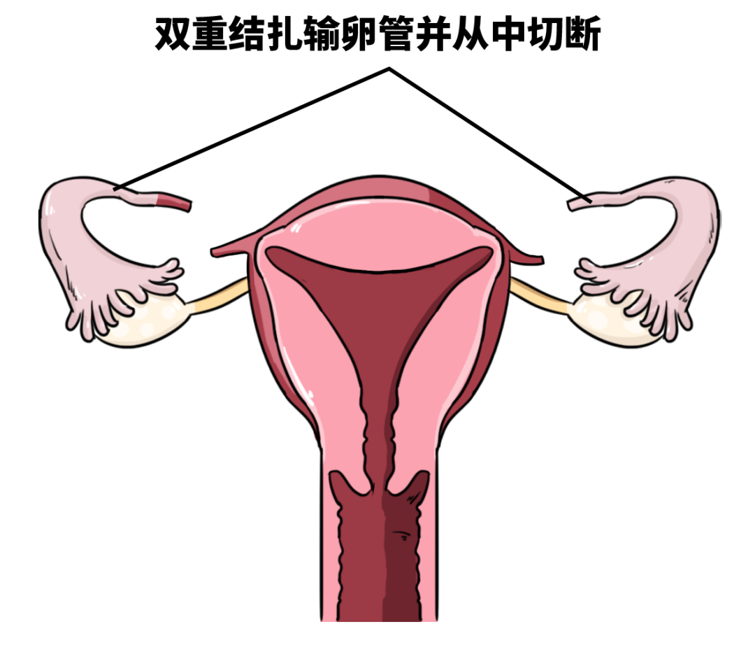 这种 不戴套 不吃药 的避孕方式 却让很多男的接受不了 什么值得买