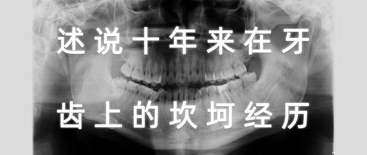 述说十年来在牙齿上的坎坷经历 拔智齿 拔多生齿 根管治疗 牙冠 洗牙 我知道的全都告诉你 口腔健康 什么值得买