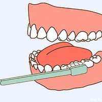 前后对比说说巴氏刷牙法的效果